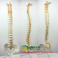 SPINE10 (12382) Quality Medical Science Anatomical Model ,Life-Size Vertebral Column with Pelvis